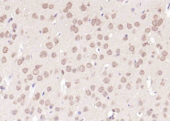 Phospho-PAK6 (Ser560) Rabbit Polyclonal Antibody
