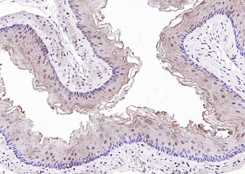 Phospho-PAK6 (Ser560) Rabbit Polyclonal Antibody