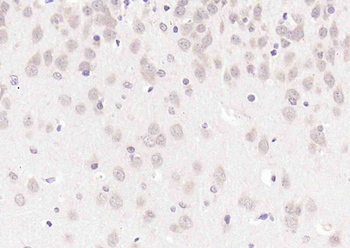 Phospho-PAK6 (Ser560) Rabbit Polyclonal Antibody