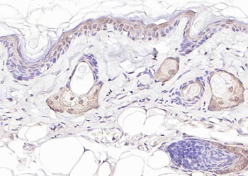 Phospho-PAK6 (Ser560) Rabbit Polyclonal Antibody
