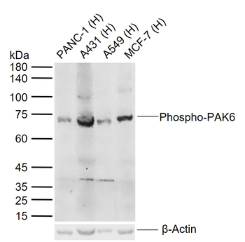 Phospho-PAK6 (Ser560) Rabbit Polyclonal Antibody