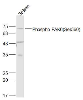 Phospho-PAK6 (Ser560) Rabbit Polyclonal Antibody