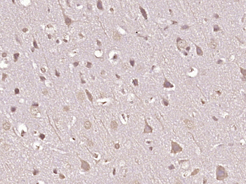 Phospho-PAK1 (Ser199 + Ser204) + PAK2 (Ser192 + Ser197) Rabbit Polyclonal Antibody