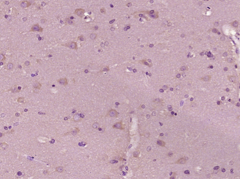 Phospho-PAK1 (Thr212) Rabbit Polyclonal Antibody