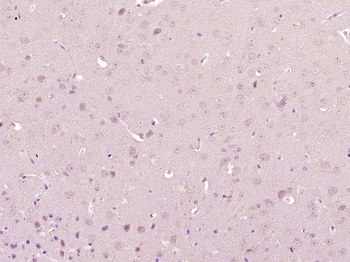 Phospho-PAK1 (Thr212) Rabbit Polyclonal Antibody