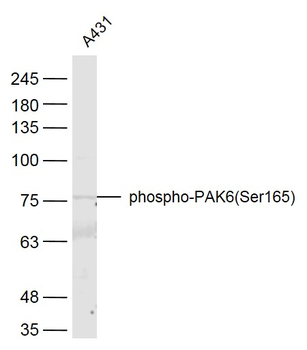 Phospho-PAK6 (Ser165) Rabbit Polyclonal Antibody