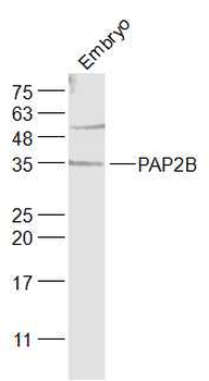 PAP2B Rabbit Polyclonal Antibody