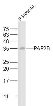 PAP2B Rabbit Polyclonal Antibody
