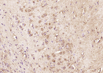 Phospho-PARK2 (Ser378) Rabbit Polyclonal Antibody