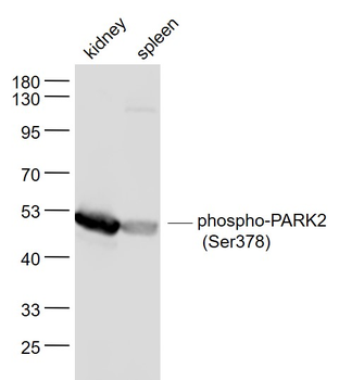 Phospho-PARK2 (Ser378) Rabbit Polyclonal Antibody