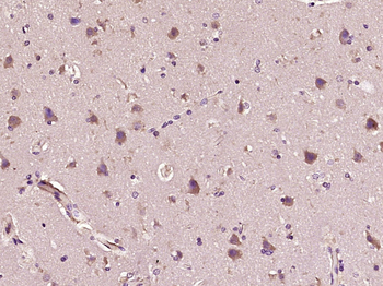 Paxillin Rabbit Polyclonal Antibody