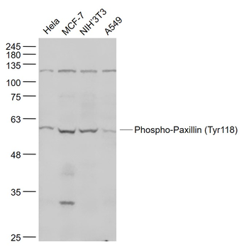 Phospho-Paxillin (Tyr118) Rabbit Polyclonal Antibody