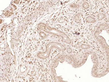 Phospho-Paxillin (Tyr31) Rabbit Polyclonal Antibody