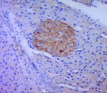 Phospho-Paxillin (Tyr88) Rabbit Polyclonal Antibody