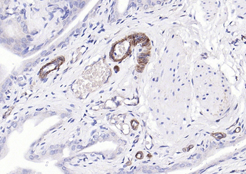 Phospho-Paxillin (Tyr88) Rabbit Polyclonal Antibody