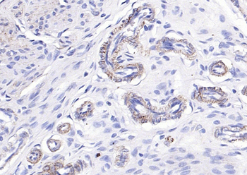 Phospho-Paxillin (Tyr88) Rabbit Polyclonal Antibody