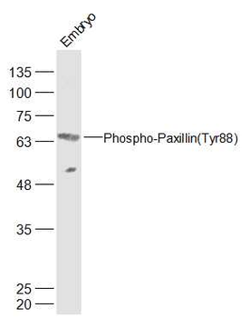 Phospho-Paxillin (Tyr88) Rabbit Polyclonal Antibody