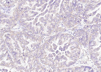 PDHA1 Rabbit Polyclonal Antibody