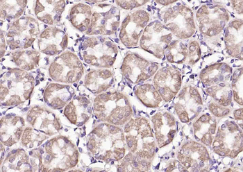 PDHA1 Rabbit Polyclonal Antibody