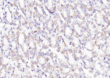 PDHA1 Rabbit Polyclonal Antibody