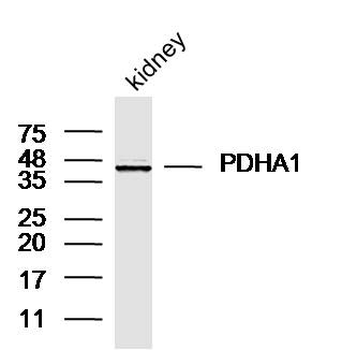 PDHA1 Rabbit Polyclonal Antibody