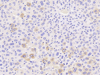 PDPK1 Rabbit Polyclonal Antibody