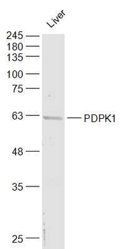 PDPK1 Rabbit Polyclonal Antibody
