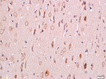 Phospho-PDK1 (Ser241) Rabbit Polyclonal Antibody