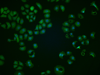 Phospho-PDPK1 (Ser393) Rabbit Polyclonal Antibody