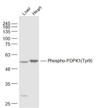 Phospho-PDPK1 (Tyr9) Rabbit Polyclonal Antibody