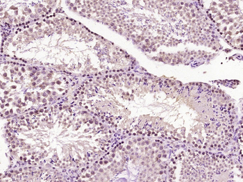 PER1 Rabbit Polyclonal Antibody