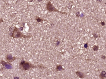 Phospho-PFKFB3/PFK2 (Ser467) Rabbit Polyclonal Antibody