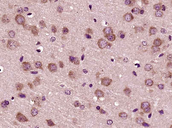 Phospho-PFKFB3/PFK2 (Ser467) Rabbit Polyclonal Antibody