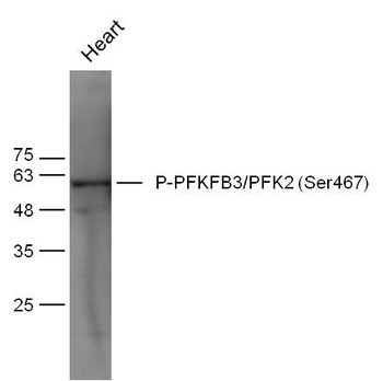 Phospho-PFKFB3/PFK2 (Ser467) Rabbit Polyclonal Antibody