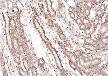 PFKM/PFK1 Rabbit Polyclonal Antibody