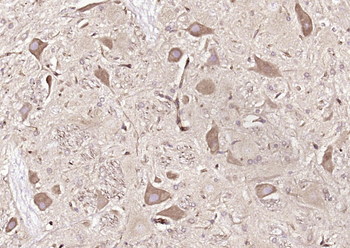 PFKM/PFK1 Rabbit Polyclonal Antibody