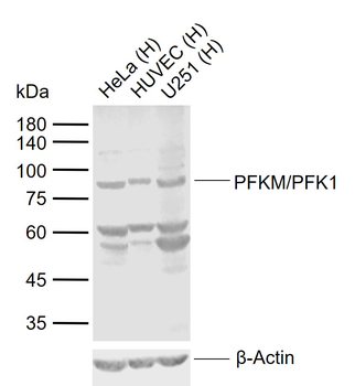 PFKM/PFK1 Rabbit Polyclonal Antibody