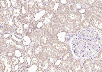 PI 3 Kinase Class 3 Rabbit Polyclonal Antibody