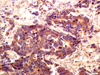 PI 3 Kinase Class 3 Rabbit Polyclonal Antibody