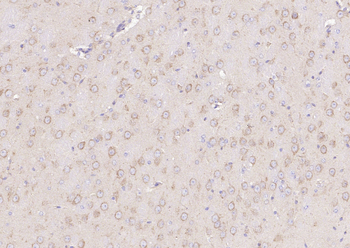 PI 3 Kinase Class 3 Rabbit Polyclonal Antibody