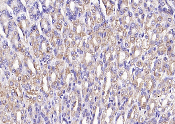 PI 3 Kinase Class 3 Rabbit Polyclonal Antibody
