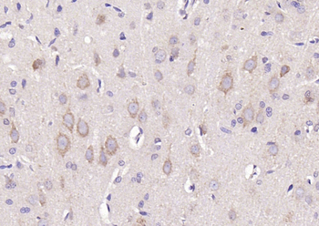 PI 3 Kinase Class 3 Rabbit Polyclonal Antibody