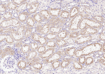 PI 3 Kinase Class 3 Rabbit Polyclonal Antibody