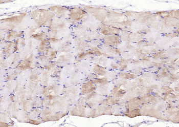 PI 3 Kinase Class 3 Rabbit Polyclonal Antibody