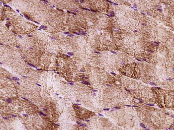 PI 3 Kinase Class 3 Rabbit Polyclonal Antibody