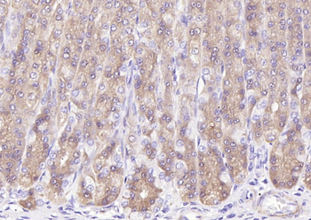 PI 3 Kinase Class 3 Rabbit Polyclonal Antibody