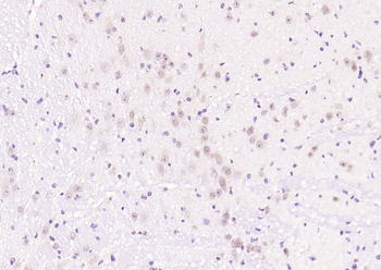 Phospho-PIK3R1 (Tyr368) Rabbit Polyclonal Antibody