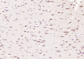 Phospho-PIK3R1 (Tyr368) Rabbit Polyclonal Antibody