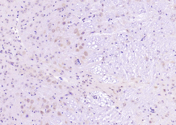 Phospho-PI3KCA (Tyr317) Rabbit Polyclonal Antibody