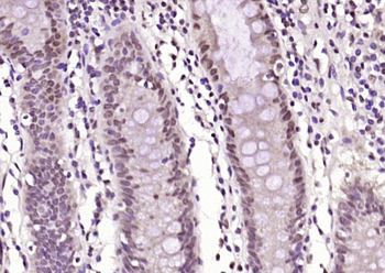 Phospho-PIM1 (Tyr309) Rabbit Polyclonal Antibody